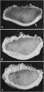 pf cartilage